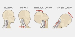 Whiplash_8dbe6371-47ab-426c-a452-fca1dc594060