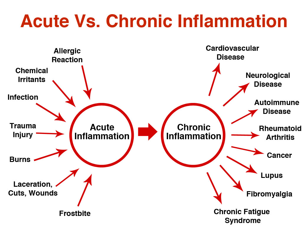 causes-of-joint-inflammation-south-shore-orthopedics